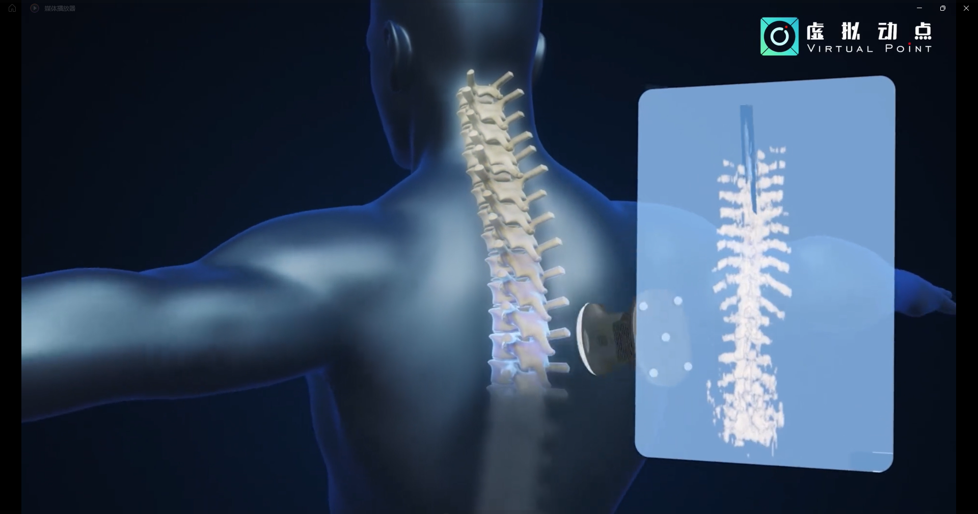 星空(中国)·虚拟动点OptiTrack开创3D超声成像在脊柱诊断中的应用